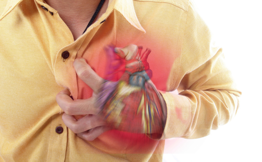 Carbonated Beverages Linked to Cardiac Arrest